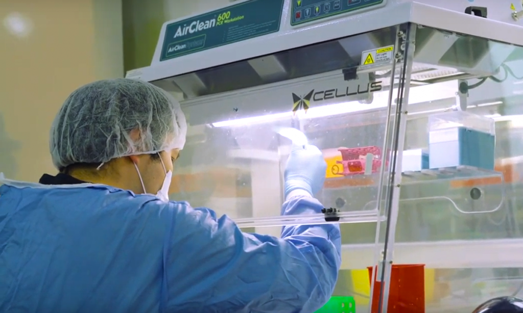 El Plasma Rico en Plaquetas se procesa en nuestro laboratorio.